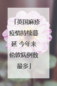 英国麻疹疫情持续蔓延 今年来伦敦病例数最多